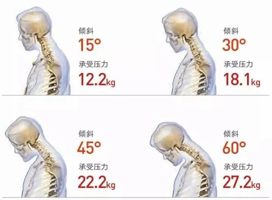 激光切割机助力金属电脑支架,解决办公族“低头病”(图2) 激光切割机助力金属电脑支架,解决办公族“低头病”